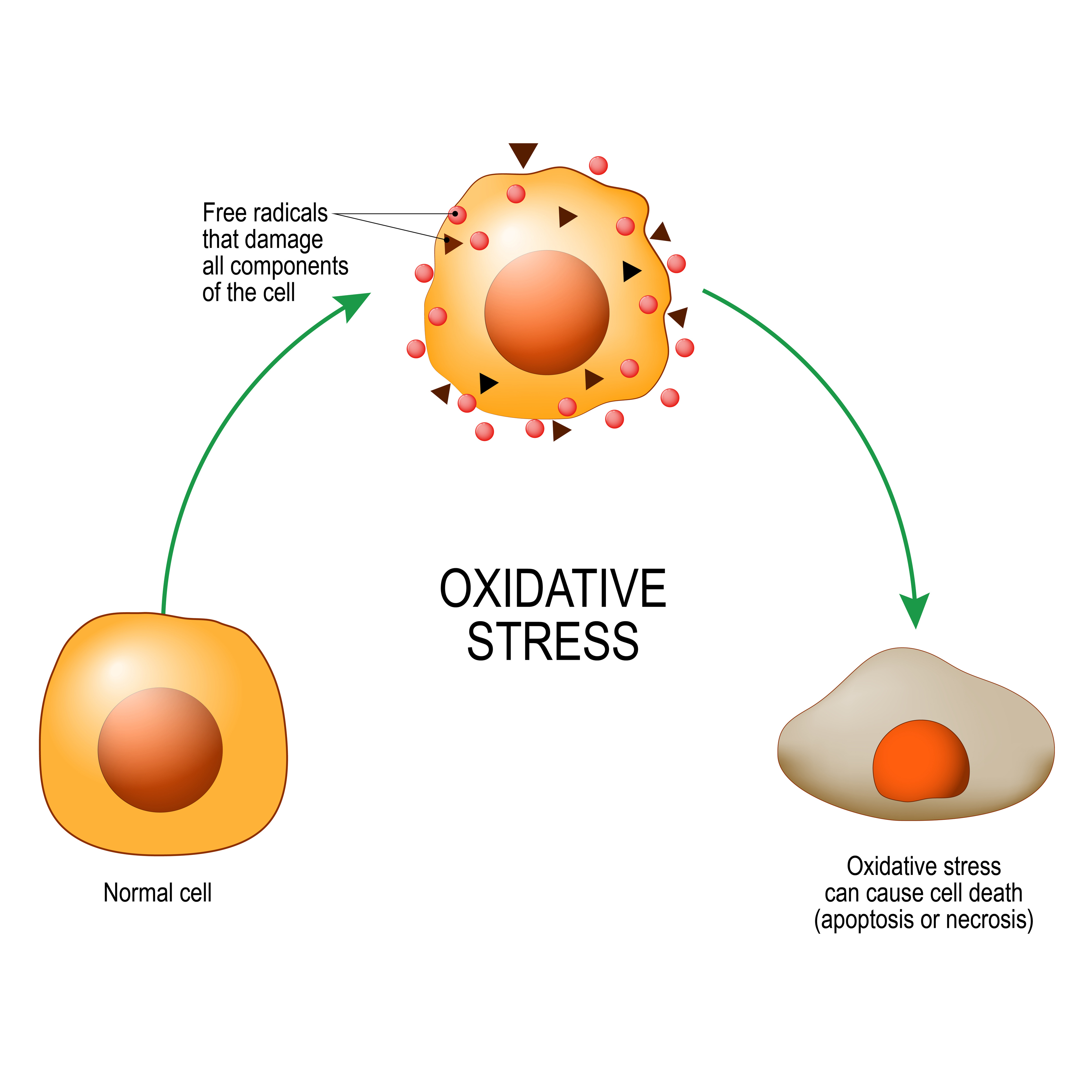 Oxidative stress. From Normal cell, to Oxidative stress and aggressive free radicals, cell death. 
